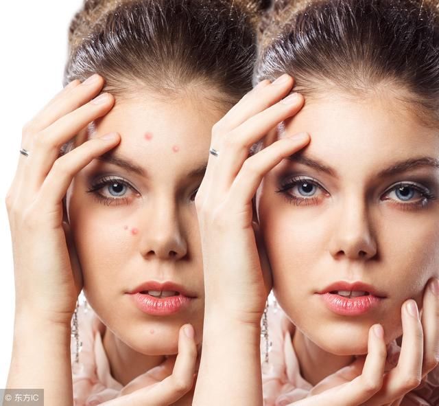 脸上出现4情况，定是螨虫过亿，教你3招逼退螨虫！