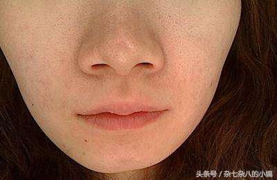 很多女人不知道，脸上有这3个表现，可能是螨虫在脸上“做窝”了