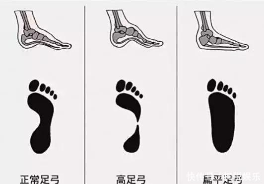 「挑选」鞋不合脚有多可怕?正确挑选女鞋方法,点我点我点我
