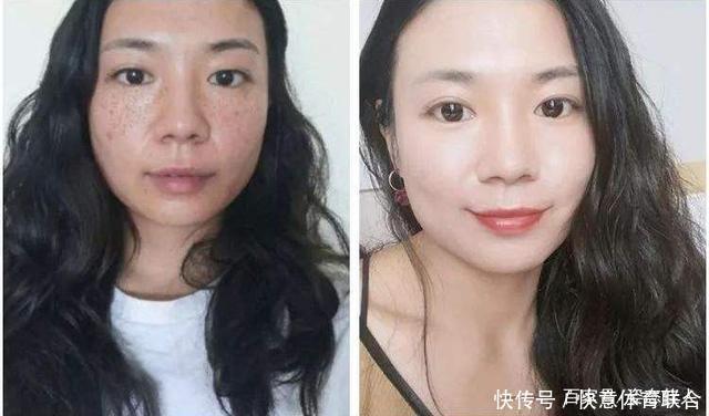 脸部:红霉素软膏加它涂抹脸部,不出15天淡斑又美白,赶紧去备上一支