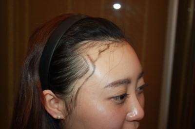 发型师透露: 女人常留这3种发型, 发际线可能会悄悄“上移”!