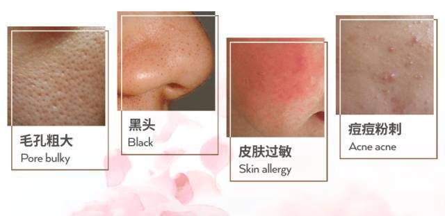 这款卸妆水为什么能打造在全球每6秒就售出一瓶的神话?