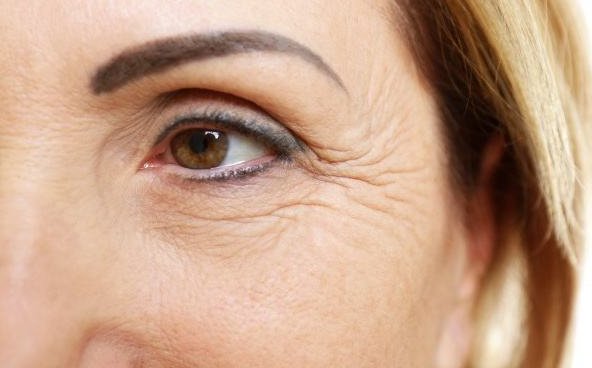  『皮肤上』长皱纹的“帮手”被发现，有这4个特点的人，很受皱纹的青睐