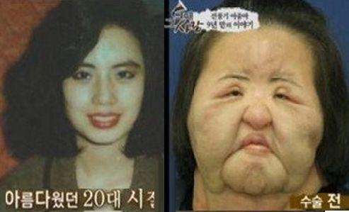 韩国女子整容走火入魔, 丈夫无奈之下只能报警!