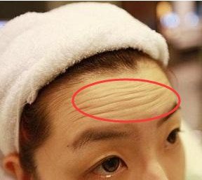 这4个地方最容易暴露女人的年纪!一定要好好保护