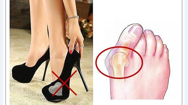 夏日露腿的季节，女生想瘦腿先改掉5个习惯，尤其第一个