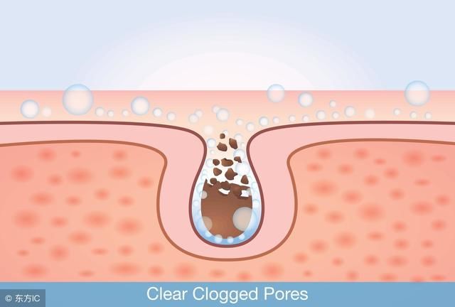 螨虫是皮肤噩梦,许多人不知道螨虫怕什么,3招