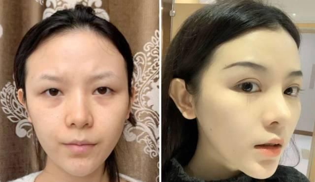  「看起来就」为什么做了整形也没有变好看