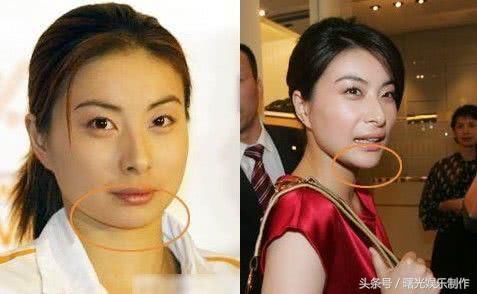 郭晶晶陷整容传闻，她真做过手术，看完就懂霍启刚为何独宠她