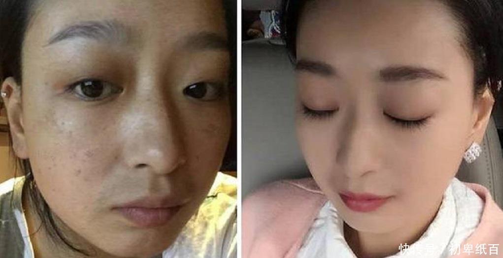 『嫩肤』土豆加“它”来敷脸,不出半个月淡化色斑又嫩肤,简单好用还省钱