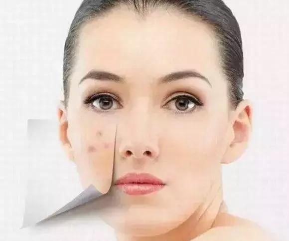 脸上长螨虫的后果由多严重?女人一定要看，别再粗心大意了