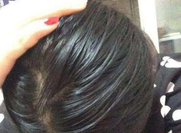  油脂：一天不洗头发，就变得很油？这些油到底是从哪里来的？