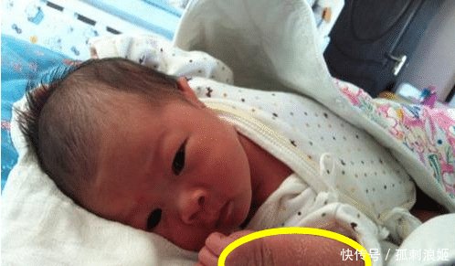 新生儿身上总脱皮 是怎么一回事育婴师讲解 婴儿皮肤护理方法