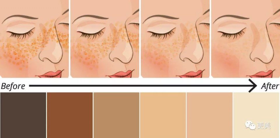 baby用CPB涂全身、林志玲打美白针，女明星为了“洗白”自己有多