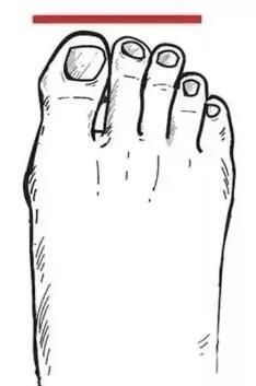 「罗马脚」女人脚型有三种,第一种穿凉鞋超好看,你是属于哪一种呢?