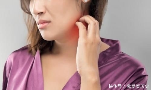 『感觉』贴上面膜火辣辣的感觉 原因有四点