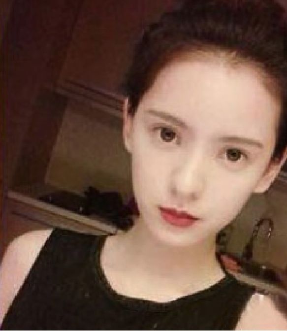 一个洋葱，一瓶白醋，睡前5分钟解决掉你祛斑，三天皮肤美白祛斑