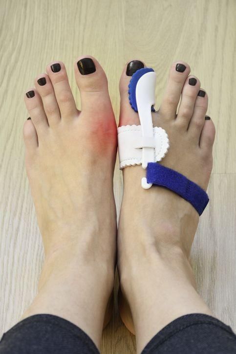 常穿高跟鞋让脚趾外翻！盘点娱乐圈4位“脸美脚丑”的女明星