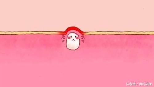 下巴紧绷后的白色颗粒到底是什么？