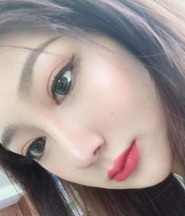  手术@隆鼻真的对颜值有影响吗？女孩术后真实记录，简直换了一个人！
