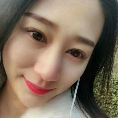 切开双眼皮真实案例分享，眼睛变大变有神了