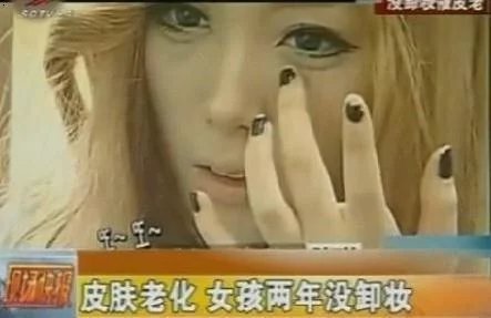 女子卸妆嫌麻烦，懒到两年不卸妆，医生帮她卸妆后直接吓懵了