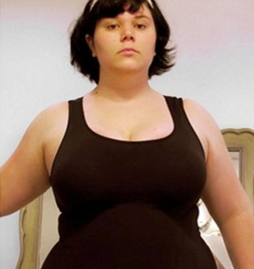 女子痴迷隆胸，三年内动刀多次，如今胸围是腰围的两倍