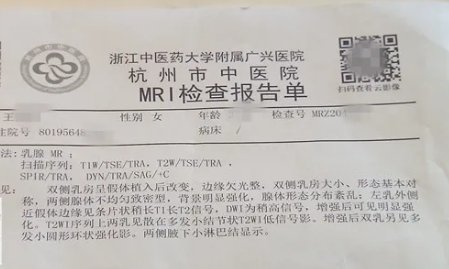 「术后」女子来沪贷款做隐私部位整形 术后胸里全是硬块 还有更令人难以启齿的状况...