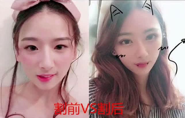 好看|割双眼皮前VS割双眼皮后,看见差距,眼睛变好看了但灵魂没了!