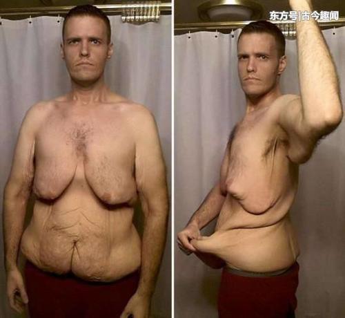 体重520斤的肥仔为爱减肥，在女网友的鼓励下成功减肥380斤