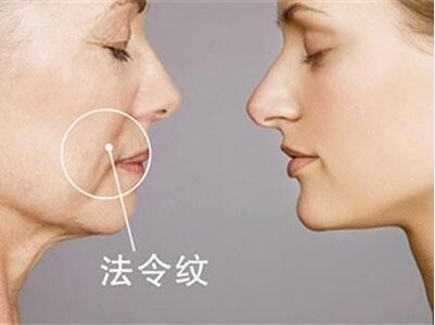 面部的哪些问题，让你看起来更老?