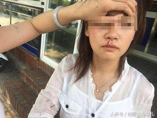 昆山公安官方微博通报，内容全面，网友呼正义必胜