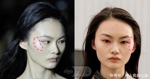 『综合』颧弓与泪沟的综合修饰，一个拯救脸型bug的神奇高光点