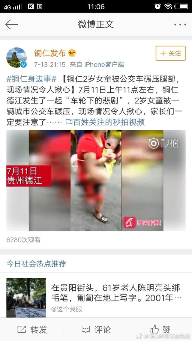 新余的朋友圈疯传一段小孩腿部严重受伤的视频为谣言！