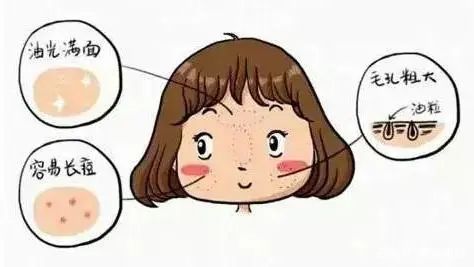 【脸上出油】天气回暖,肌肤容易出油咋办?