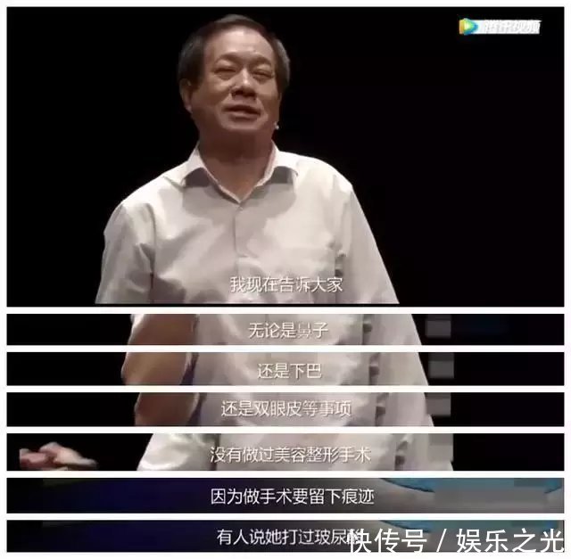 杨颖整容鉴定另有玄机? 医生公开现身辟谣, 网友: 整得好失败!