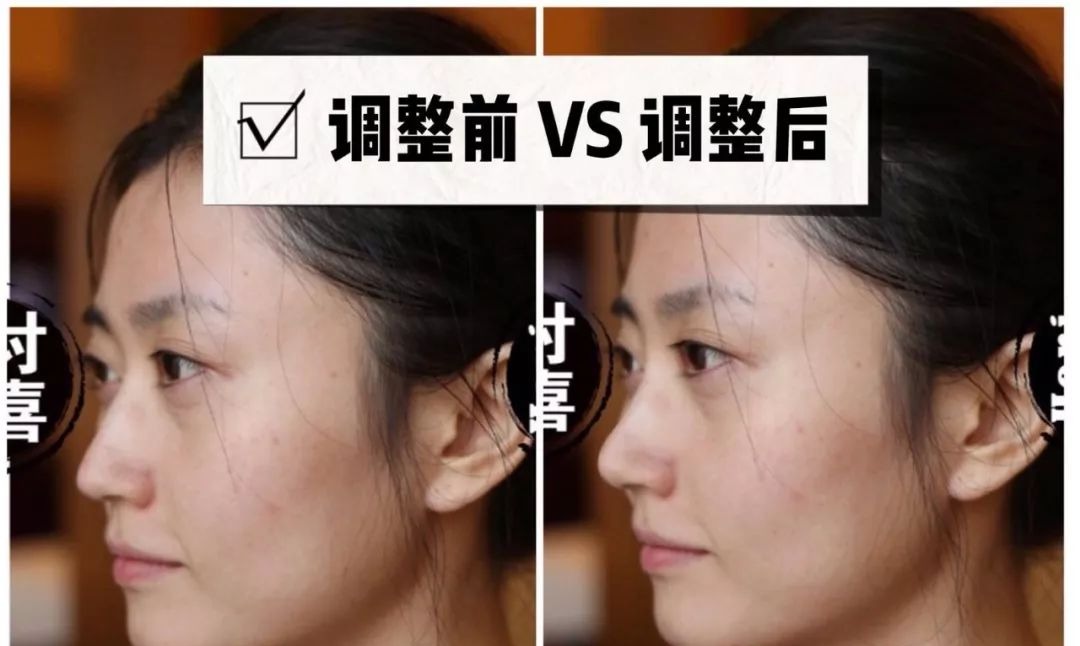 「衰老问题」素人整形分析 | 做对这些,宽方脸比瓜子脸更有优势