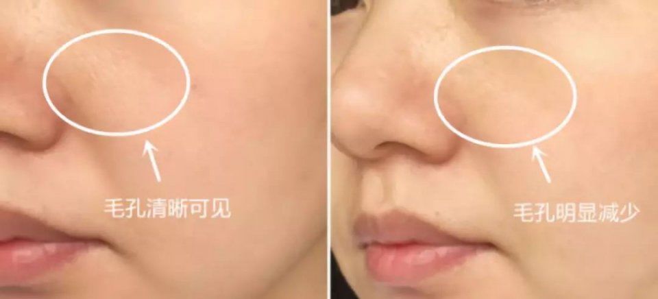 越抹越凉爽，补水不油腻?难怪这款澳洲面霜成为美妆大V的心头肉!