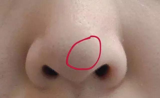 明星素颜哪家强?赵丽颖霍思燕黑头明显，林允真的没毛孔!