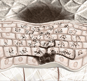 黄褐斑在脸上扎堆怎么办？用对这2招，轻松下斑脸蛋白净