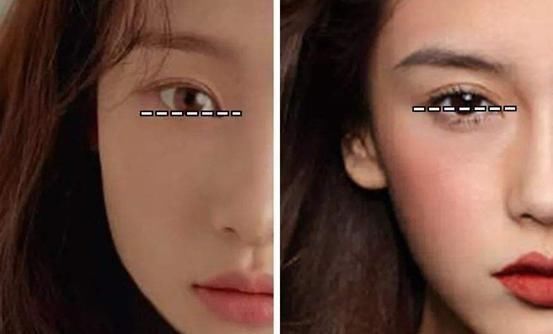  微笑：双倍大眼不用整容，蔡卓宜微笑眼的秘密都在这，宝藏眼睑下至术