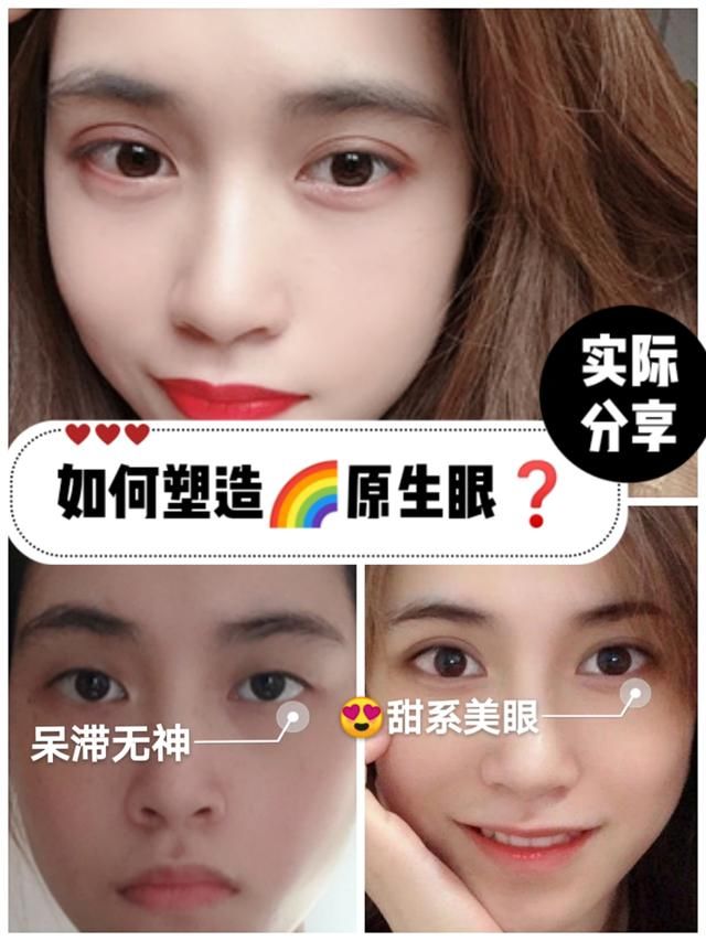  【明明】明明眼睛比之前大了，却越来越丑？这是什么操作