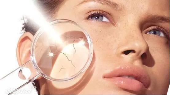 面部皱纹是皮肤一大难题!找出原因，才能对症治疗