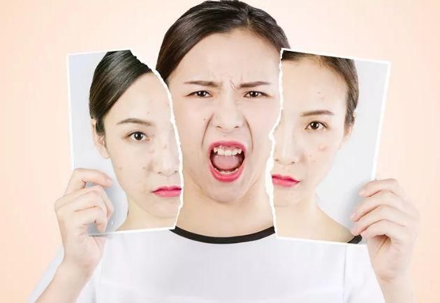 P照片不如“P”现实的脸，皮肤底子好素颜也任性！