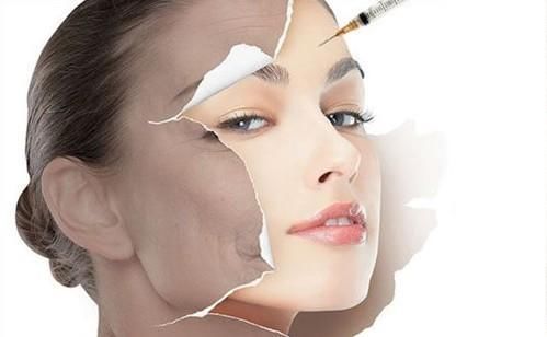 不要盲目注射：玻尿酸要选对品牌！