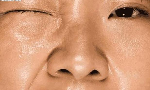 毛孔粗成坑到处都是洞,每天睡前坚持1件事,紧缩毛孔又小又细