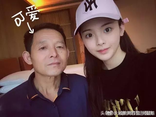 苹果肌和高颧骨之间有超大区别，你分得清楚吗？