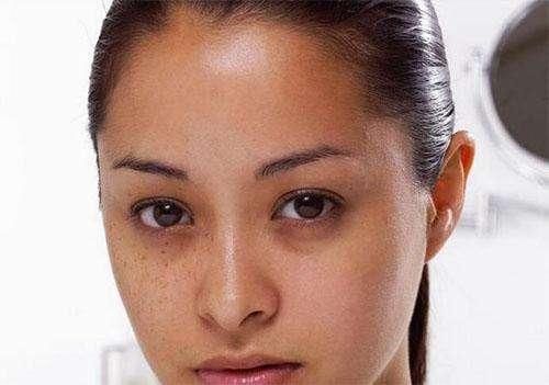 长螨虫期，脸上最明显表现有4点，原是美丽杀手，你有中招吗？