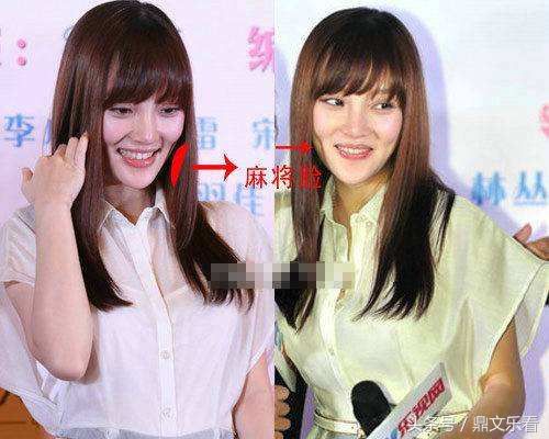 李小璐本来整的挺美挺性感的 还不满足结果整容过度导致脸部扭曲