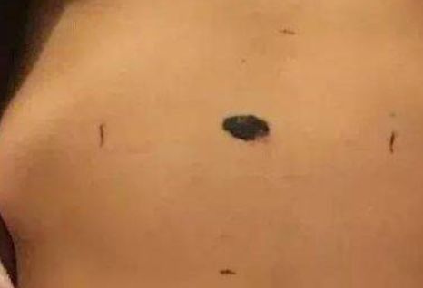 年轻女子发朋友圈晒美照，朋友看到后叫她去医院，真相让人傻了眼